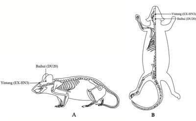 Possible Involvement of Tissue Plasminogen Activator/Brain-Derived Neurotrophic Factor Pathway in Anti-Depressant Effects of Electroacupuncture in Chronic Unpredictable Mild Stress-Induced Depression in Rats